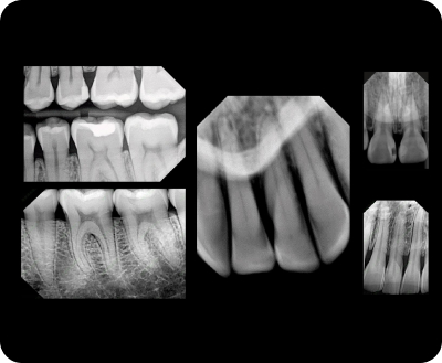 Технология прецизионных датчиков.jpg
