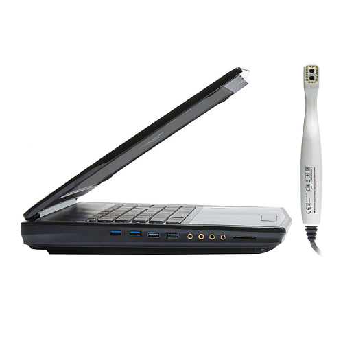 Condor - интраоральный сканер