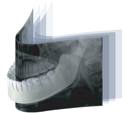 GENORAY Papaya - ортопантомограф