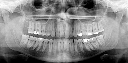Owandy I-Max Touch 3D – Конусно-лучевой томограф 9х8