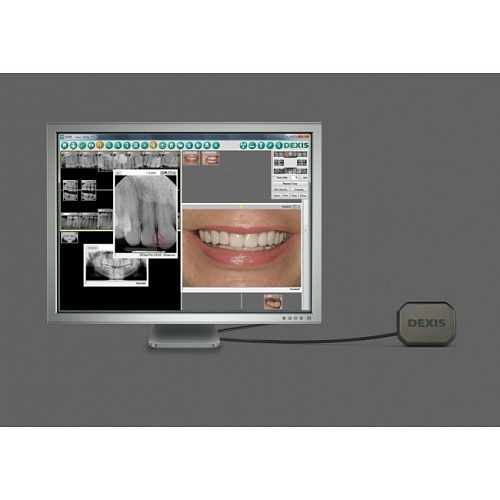 DEXIS Platinum - портативная цифровая рентгенографическая система