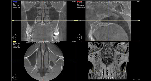 Owandy I-Max Touch 3D – Конусно-лучевой томограф 9х8